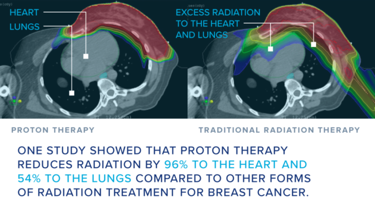 Breast Cancer Patients - Oklahoma Cancer Center